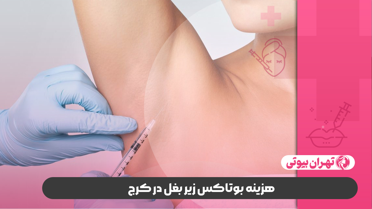 10 بهترین دکتر بوتاکس زیر بغل در کرج