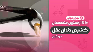 10 بهترین دکتر کشیدن دندان عقل در کرج