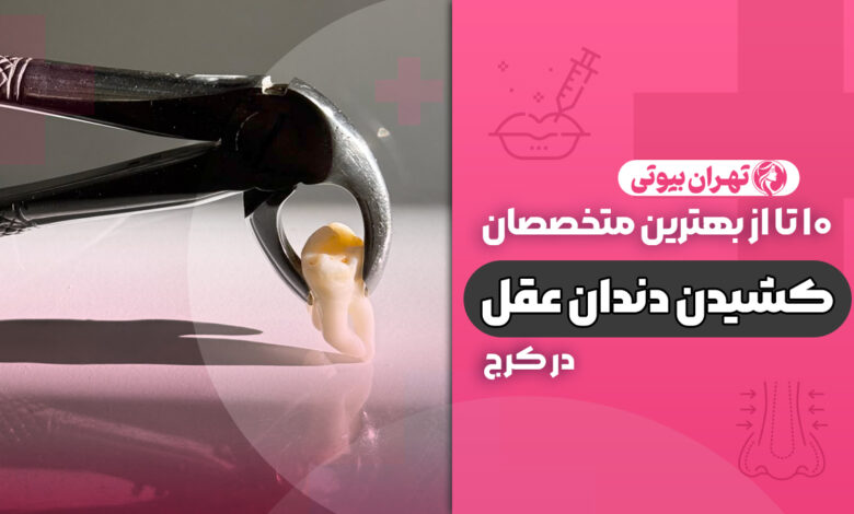 10 بهترین دکتر کشیدن دندان عقل در کرج