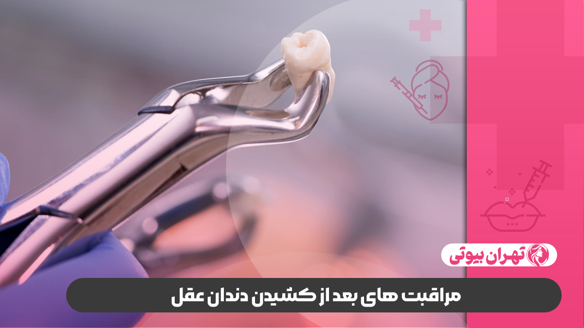10 بهترین دکتر کشیدن دندان عقل در کرج