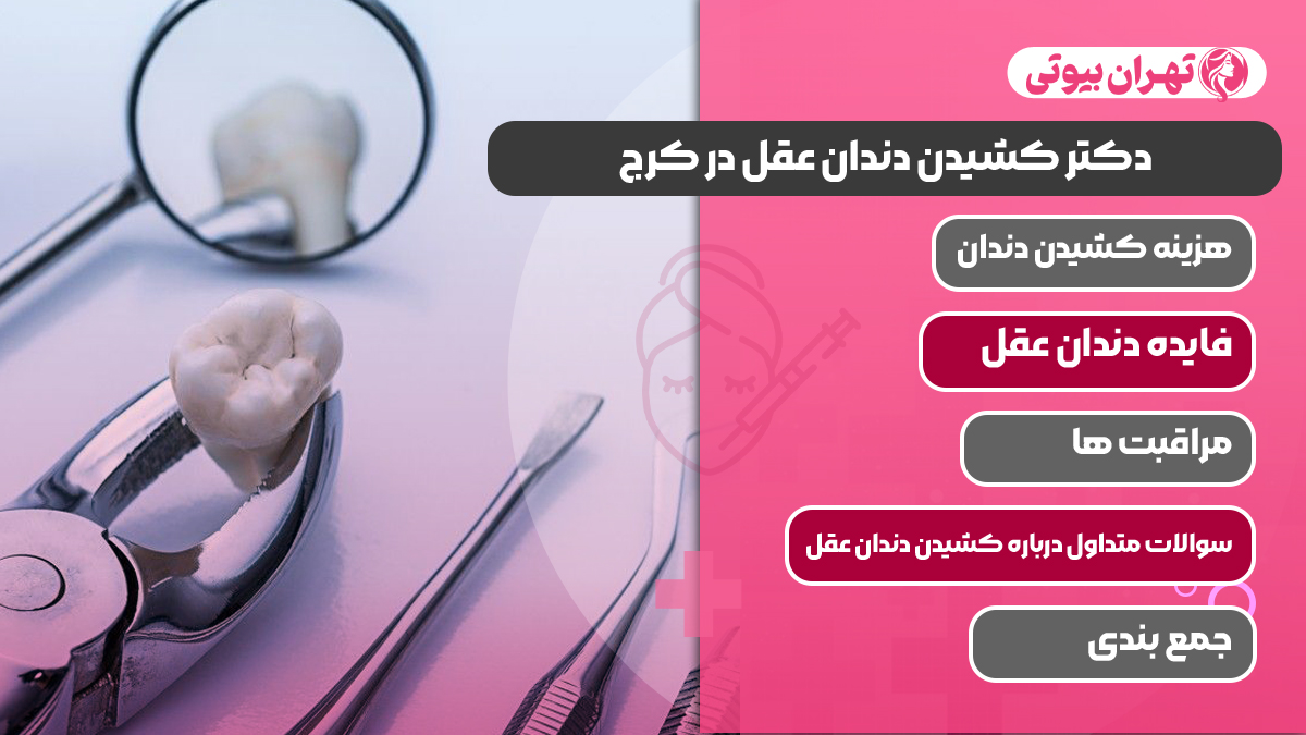10 بهترین دکتر کشیدن دندان عقل در کرج