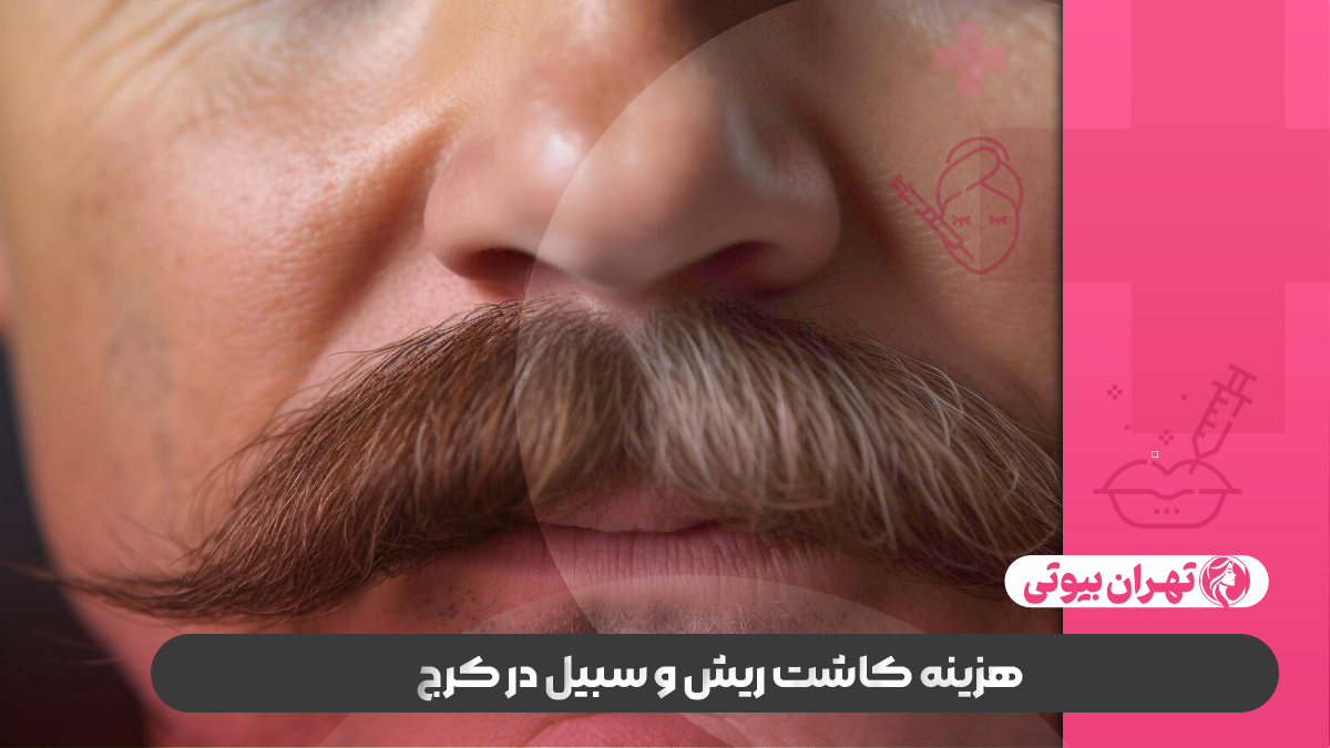 10 بهترین کلینیک کاشت ریش و سبیل در کرج