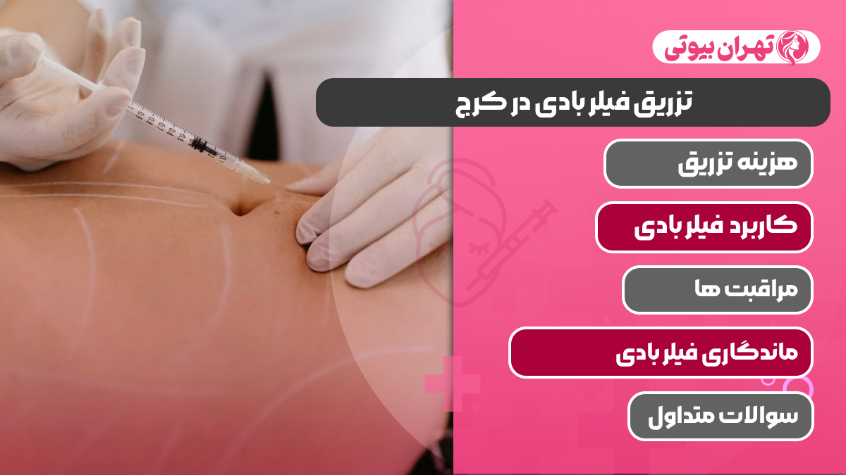 10 بهترین دکتر تزریق فیلر بادی در کرج