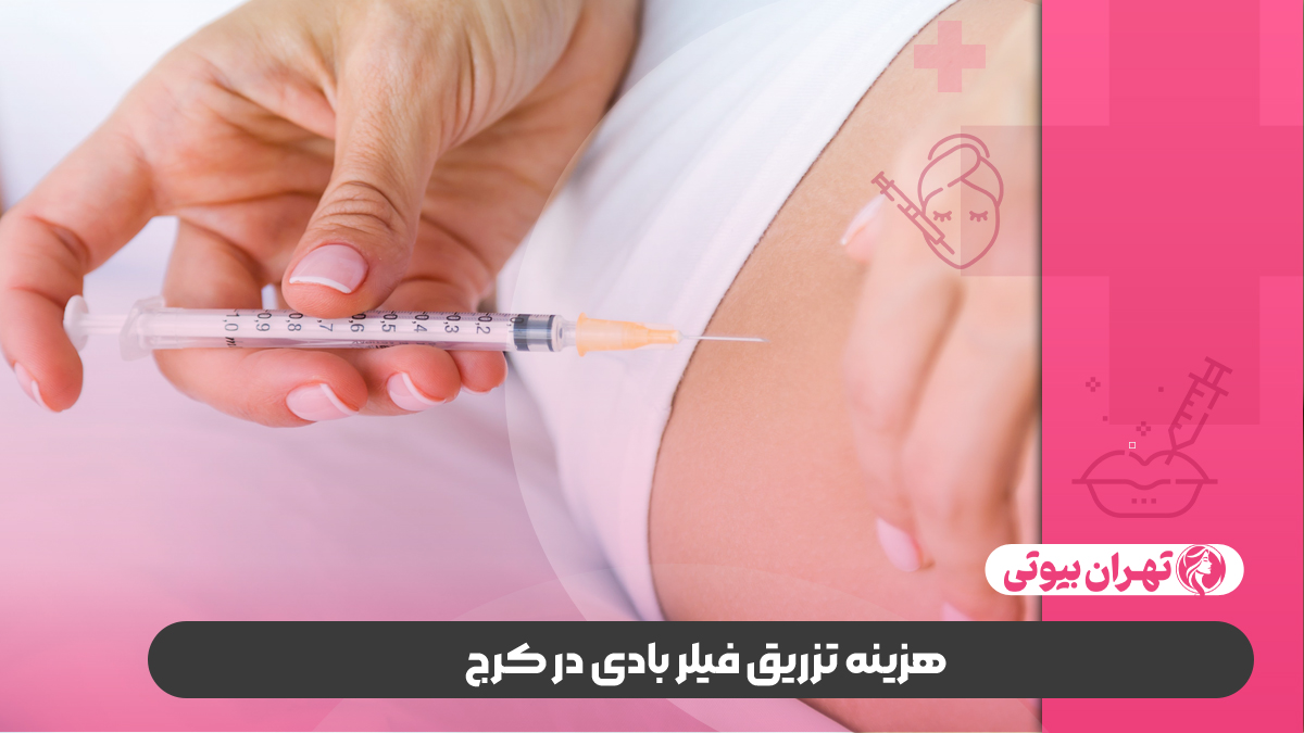 10 بهترین دکتر تزریق فیلر بادی در کرج