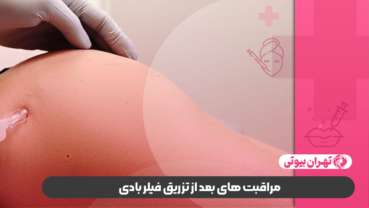 10 بهترین دکتر تزریق فیلر بادی در کرج