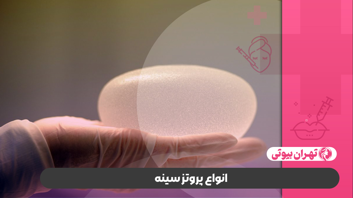 10 بهترین جراح پروتز سینه در کرج
