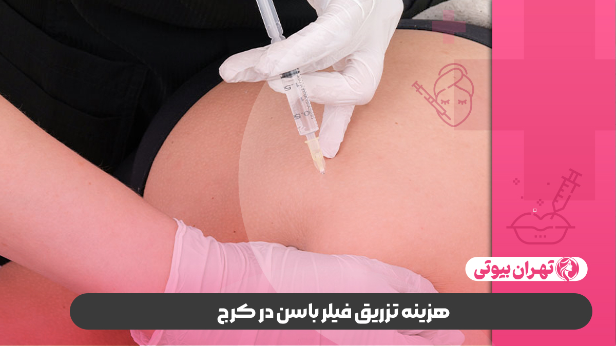 10 بهترین دکتر تزریق فیلر باسن در کرج