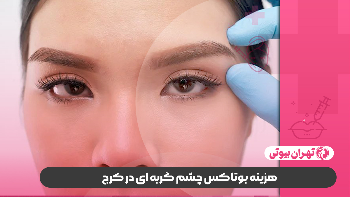 10 بهترین دکتر تزریق بوتاکس چشم گربه ای در کرج