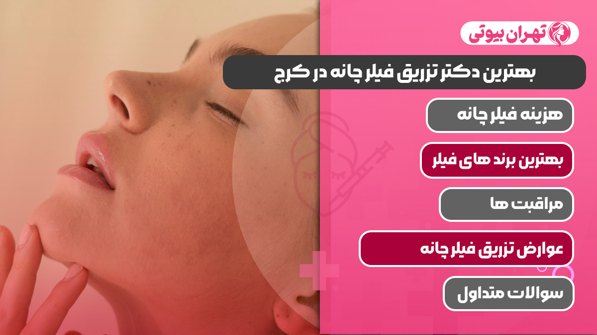 10 بهترین دکتر تزریق فیلر چانه در کرج