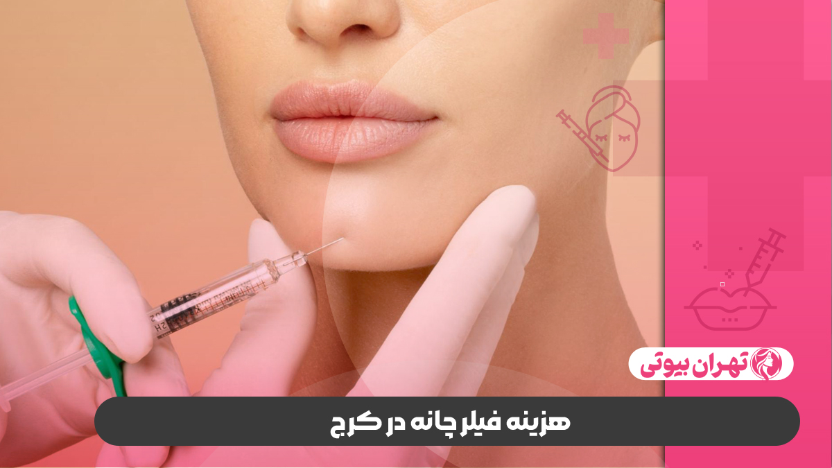 10 بهترین دکتر تزریق فیلر چانه در کرج