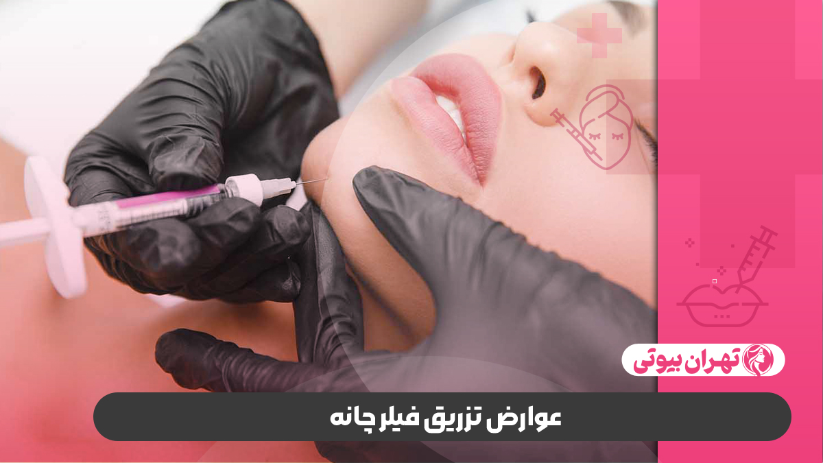 10 بهترین دکتر تزریق فیلر چانه در کرج