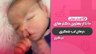 10 بهترین دکتر درمان لب شکری در کرج (شکاف کام و لب)