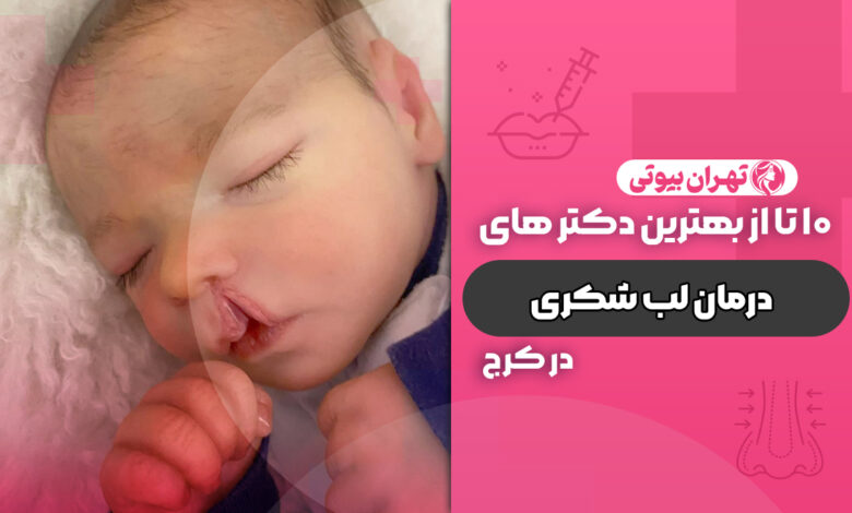 10 بهترین دکتر درمان لب شکری در کرج (شکاف کام و لب)
