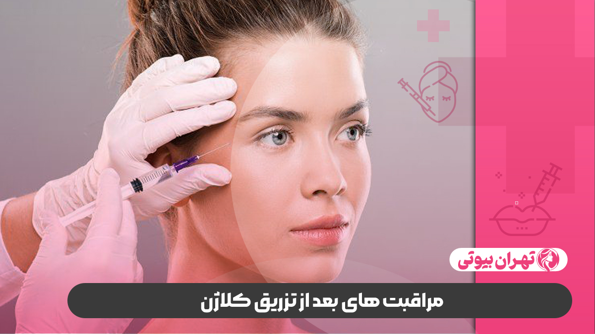 10 بهترین دکتر تزریق کلاژن در کرج