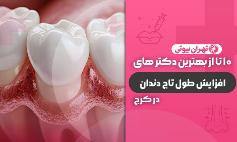 10 بهترین متخصص افزایش طول تاج دندان در کرج
