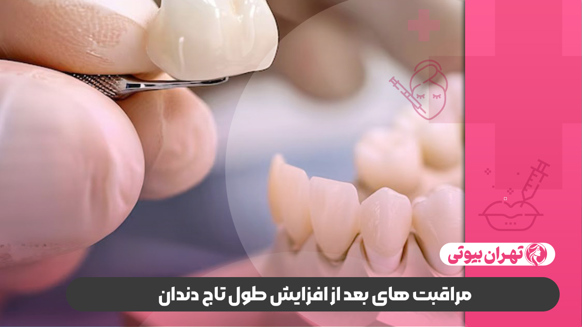 10 بهترین متخصص افزایش طول تاج دندان در کرج