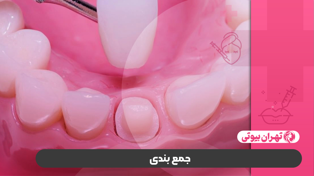 10 بهترین متخصص افزایش طول تاج دندان در کرج