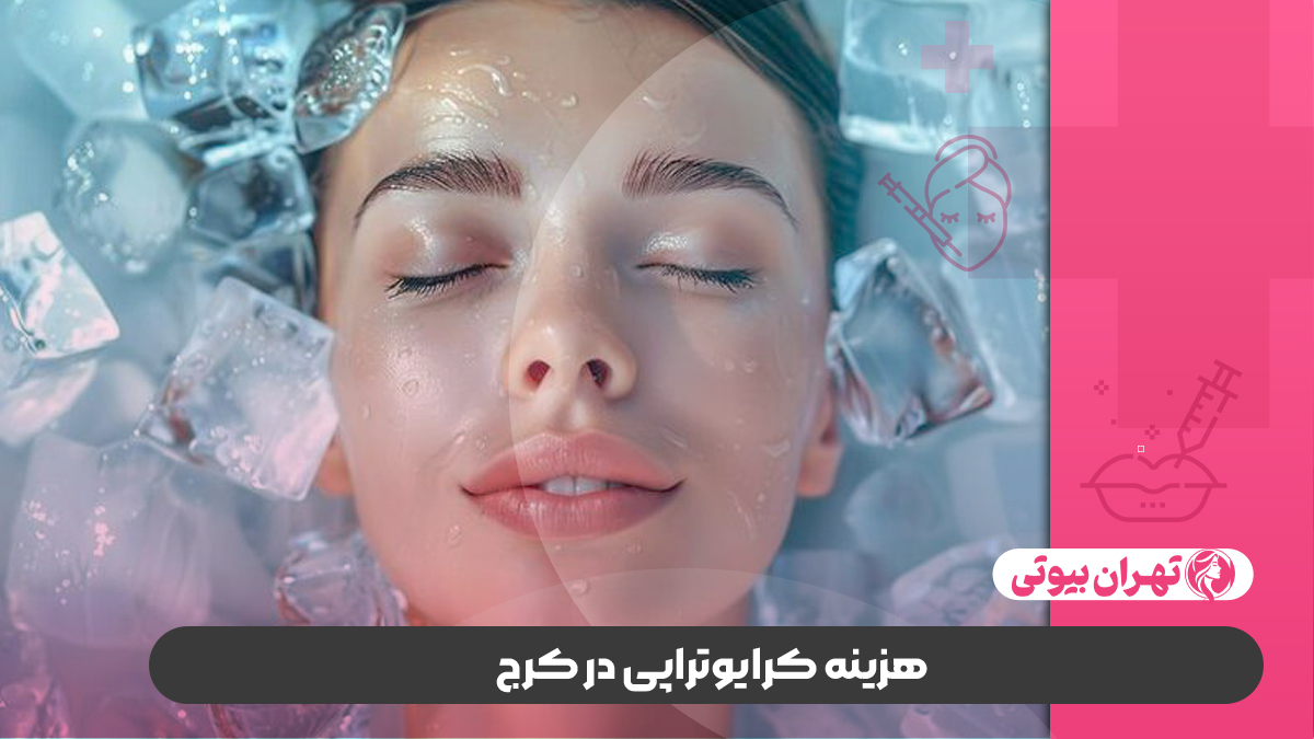 10 بهترین دکتر کرایوتراپی در کرج
