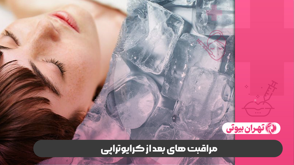 10 بهترین دکتر کرایوتراپی در کرج