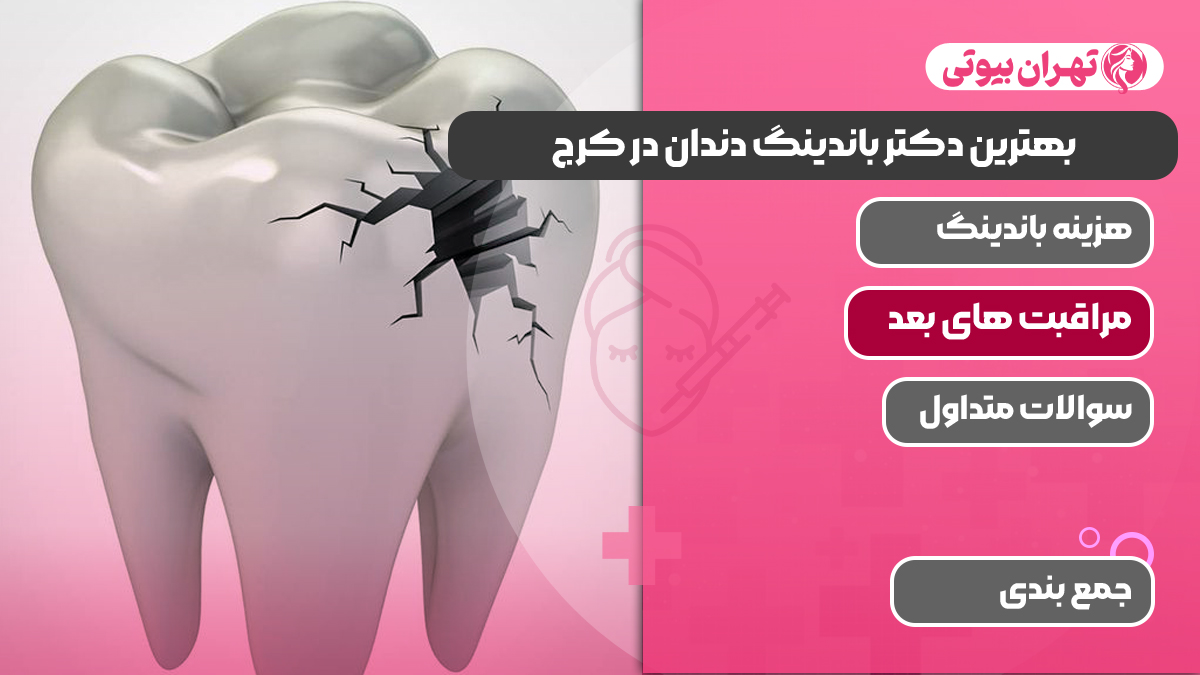 10 بهترین دکتر باندینگ دندان در کرج (پیوند دندان)
