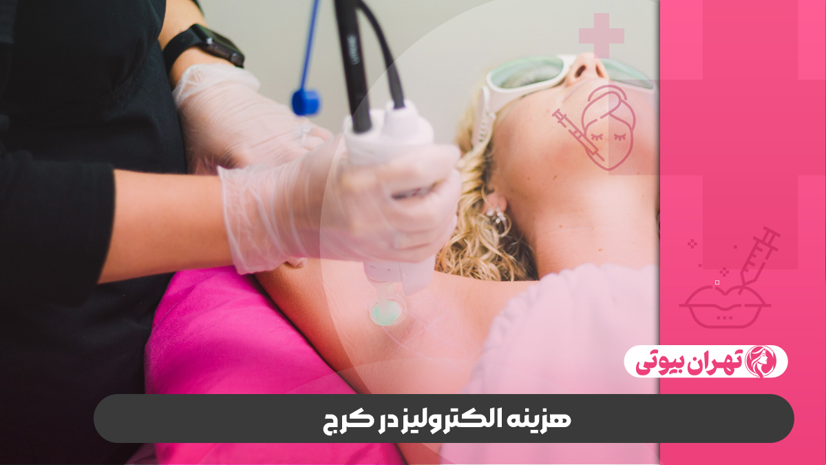 10 بهترین مرکز الکترولیز در کرج