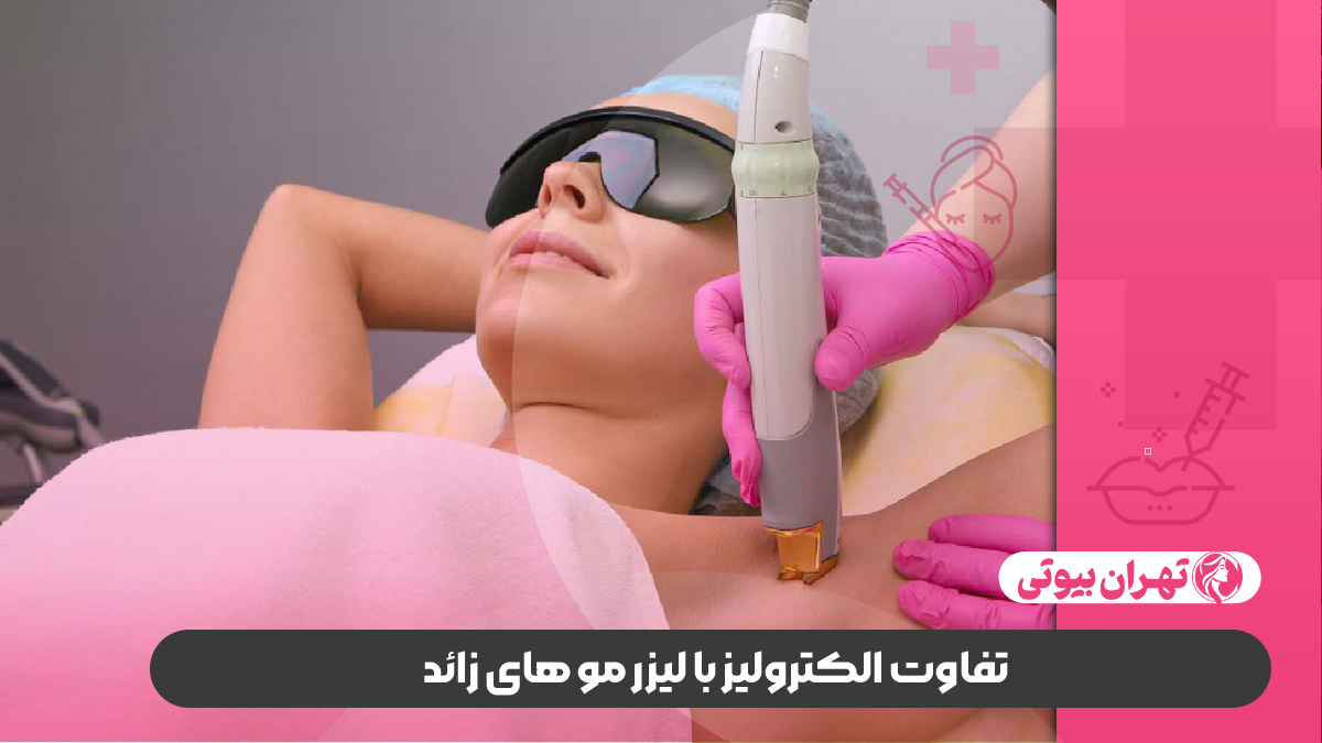10 بهترین مرکز الکترولیز در کرج