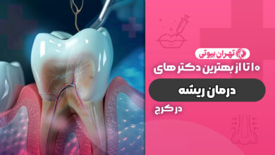 10 بهترین متخصص درمان ریشه در کرج