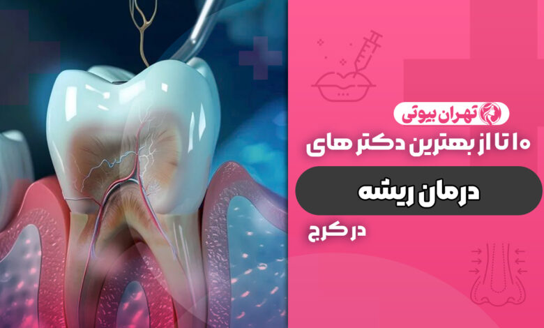 10 بهترین متخصص درمان ریشه در کرج