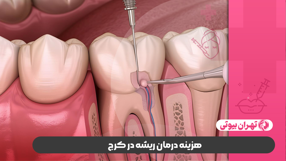 10 بهترین متخصص درمان ریشه در کرج