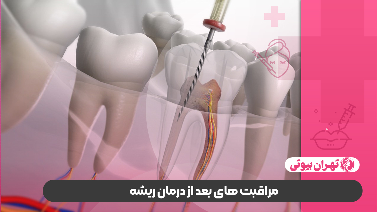 10 بهترین متخصص درمان ریشه در کرج