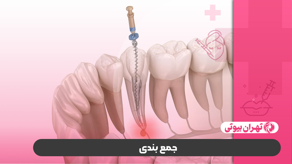 10 بهترین متخصص درمان ریشه در کرج