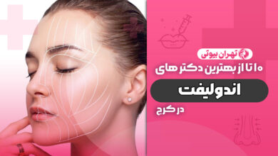 10 بهترین دکتر اندولیفت در کرج