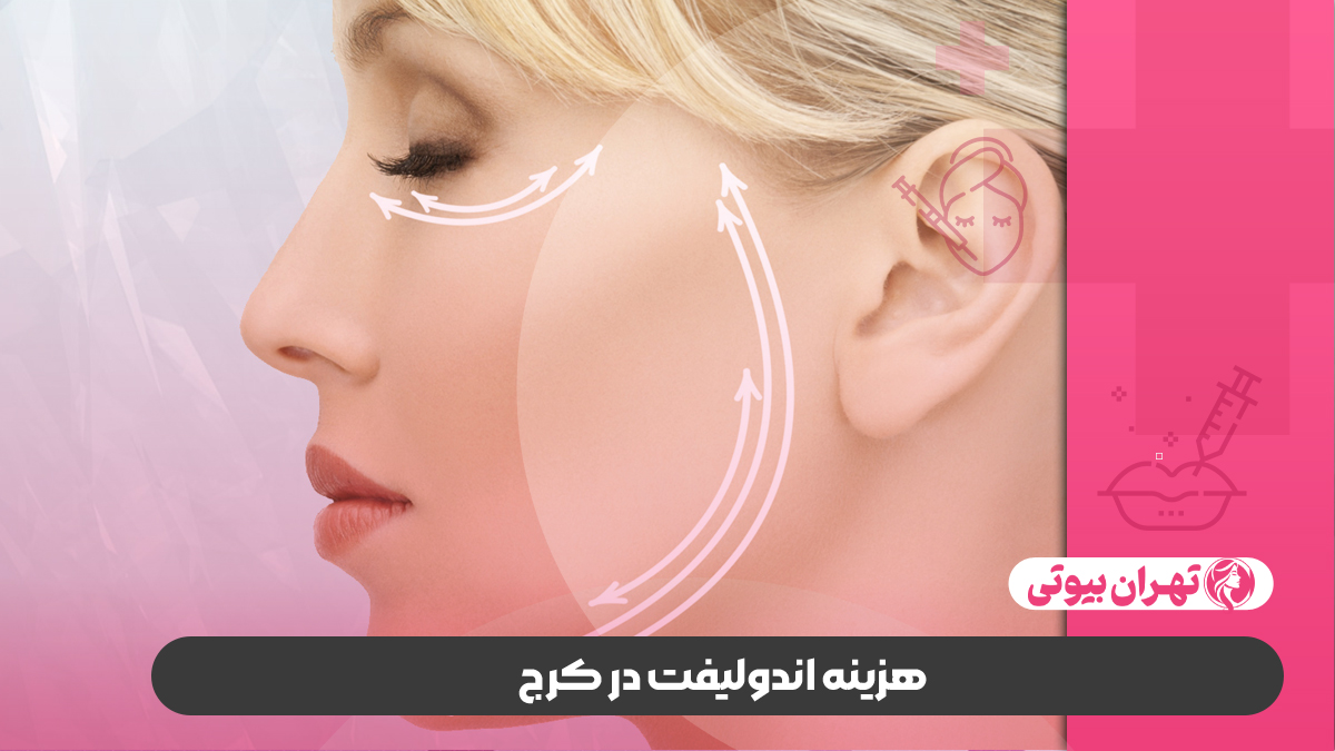 10 بهترین دکتر اندولیفت در کرج