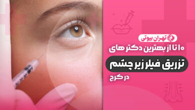 10 بهترین دکتر تزریق فیلر زیر چشم در کرج