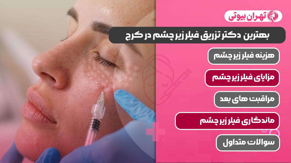 10 بهترین دکتر تزریق فیلر زیر چشم در کرج