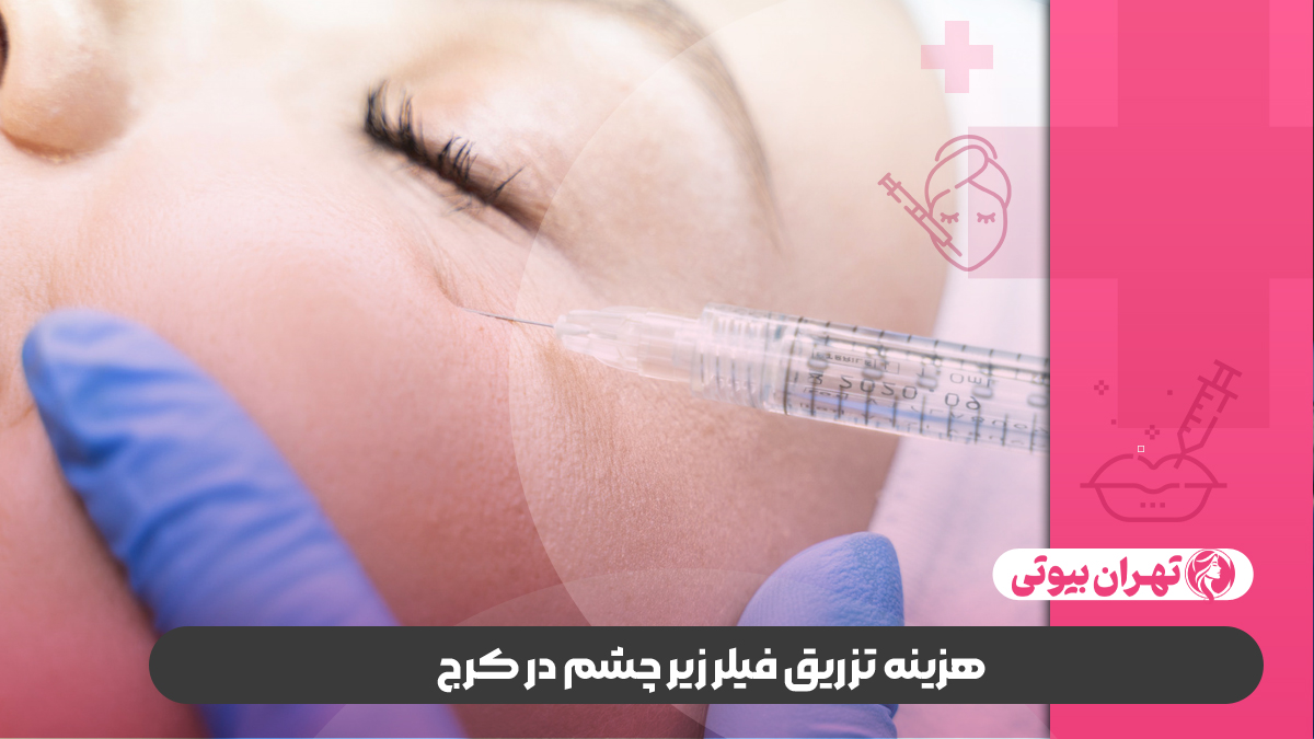 10 بهترین دکتر تزریق فیلر زیر چشم در کرج