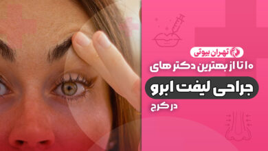10 بهترین دکتر جراحی لیفت ابرو در کرج