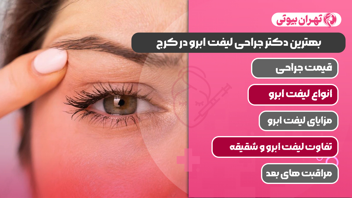 10 بهترین دکتر جراحی لیفت ابرو در کرج