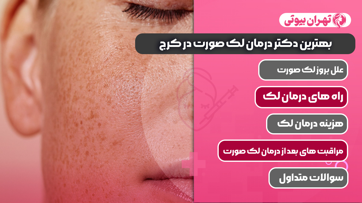 10 بهترین دکتر درمان لک صورت در کرج