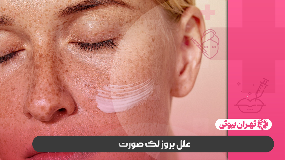 10 بهترین دکتر درمان لک صورت در کرج