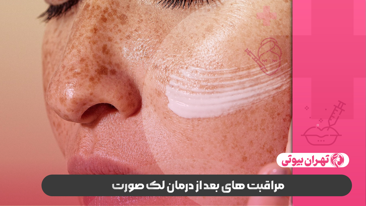 10 بهترین دکتر درمان لک صورت در کرج