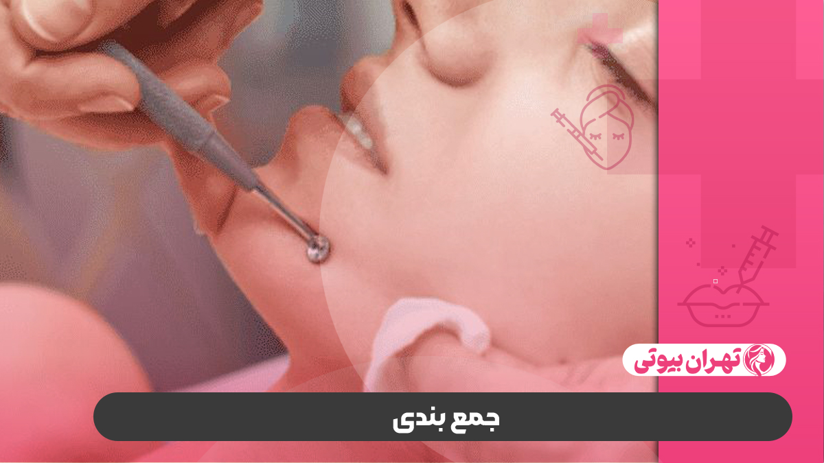 10 بهترین مرکز پانچ صورت در کرج