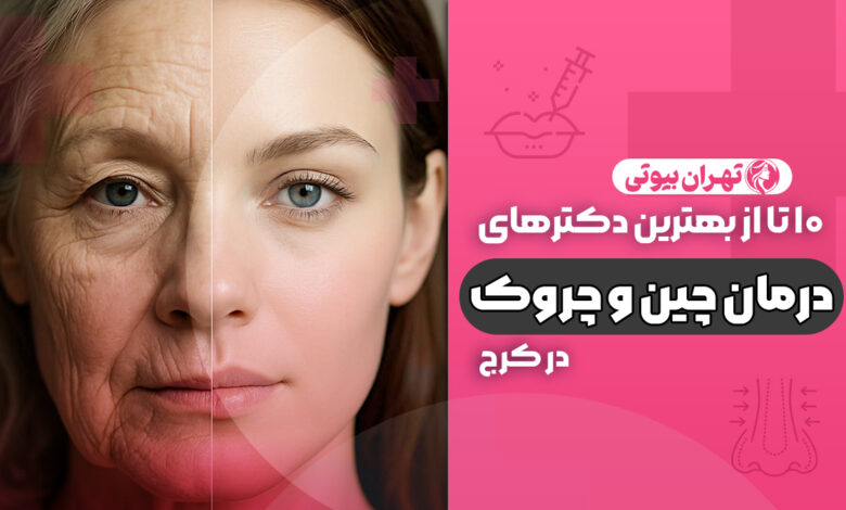 10 بهترین دکتر درمان چین و چروک صورت در کرج