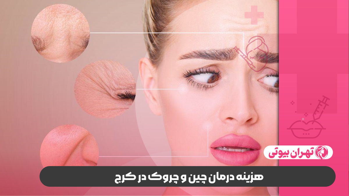 10 بهترین دکتر درمان چین و چروک صورت در کرج