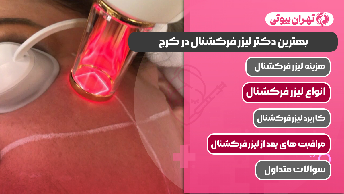 10 بهترین دکتر لیزر فرکشنال در کرج
