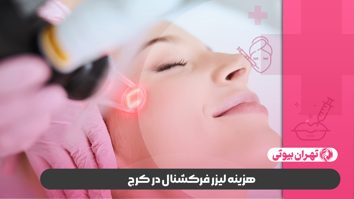 10 بهترین دکتر لیزر فرکشنال در کرج