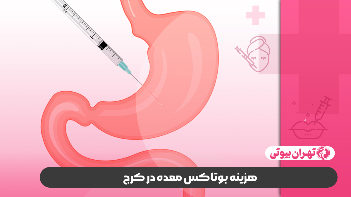 10 بهترین دکتر بوتاکس معده در کرج