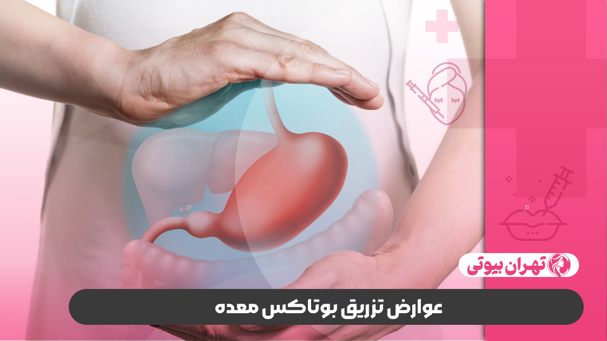 10 بهترین دکتر بوتاکس معده در کرج