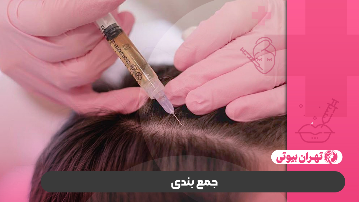 10 بهترین دکتر تزریق هیر فیلر در کرج