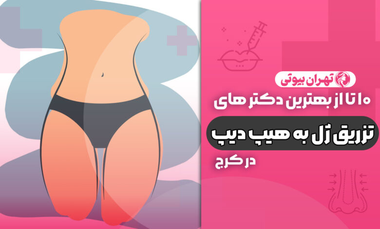 10 بهترین دکتر تزریق ژل به هیپ دیپ در کرج
